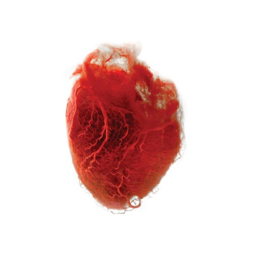 Akron/Family: Love Is Simple (Vinyl)